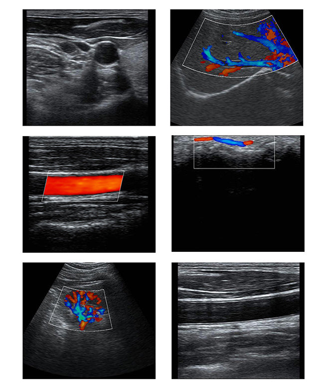 Wireless Ultrasound Machine
