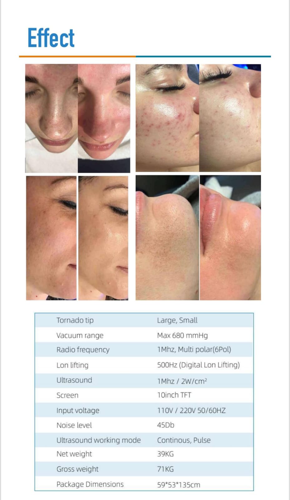 HYDRAFACIAL MACHINE- KOREA
