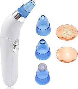 Vacuum Blackhead Remover
