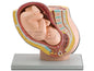 PREGNANCY PELVIS WITH MATURE FETUS - 1X